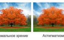 Как выявить астигматизм: главные признаки патологии
