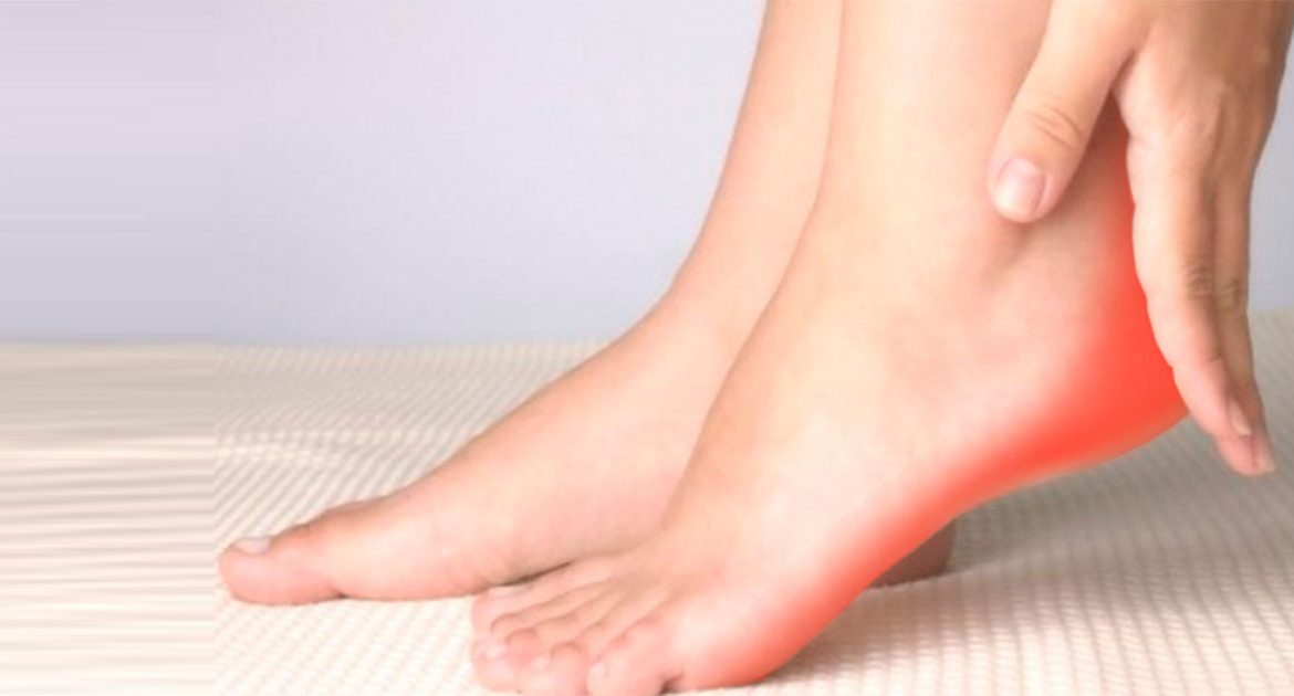 Плантарный фасциит