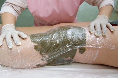 грязелечение