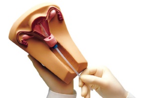 Подготовка к установке ВМС Нова Т